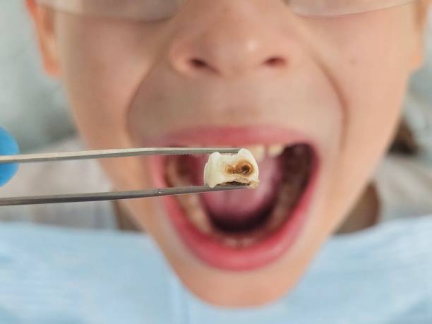 Best Tooth Infection Emergency Dentist  in Medford, MN